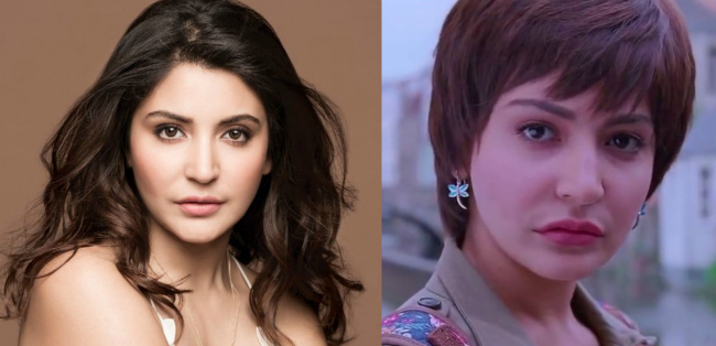 10 Bollywood Celebrities whose Plastic Surgery was a drastic Failure